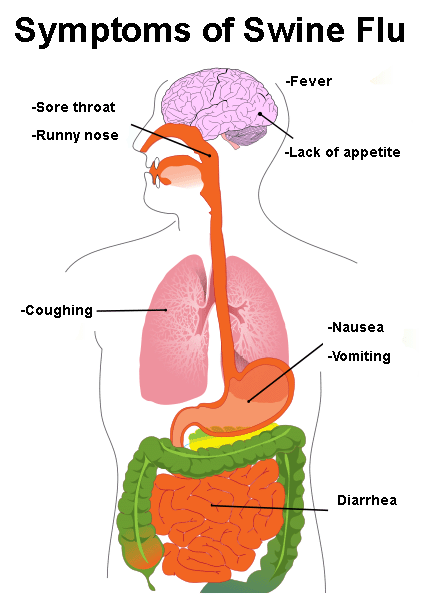 of symptoms for swine flu